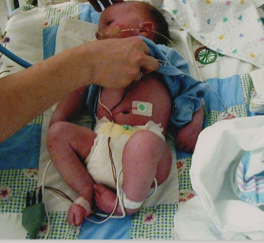 Infant in the NICU