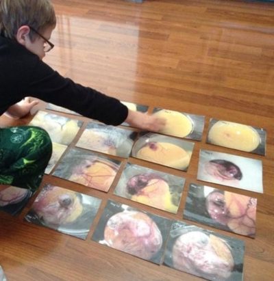 Boy using Chick's Developmental Cards